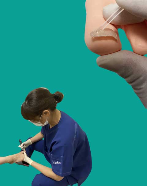 十三 淀川区で巻き爪矯正なら 淀川十三巻き爪センター